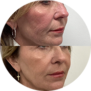 Non-Surgical